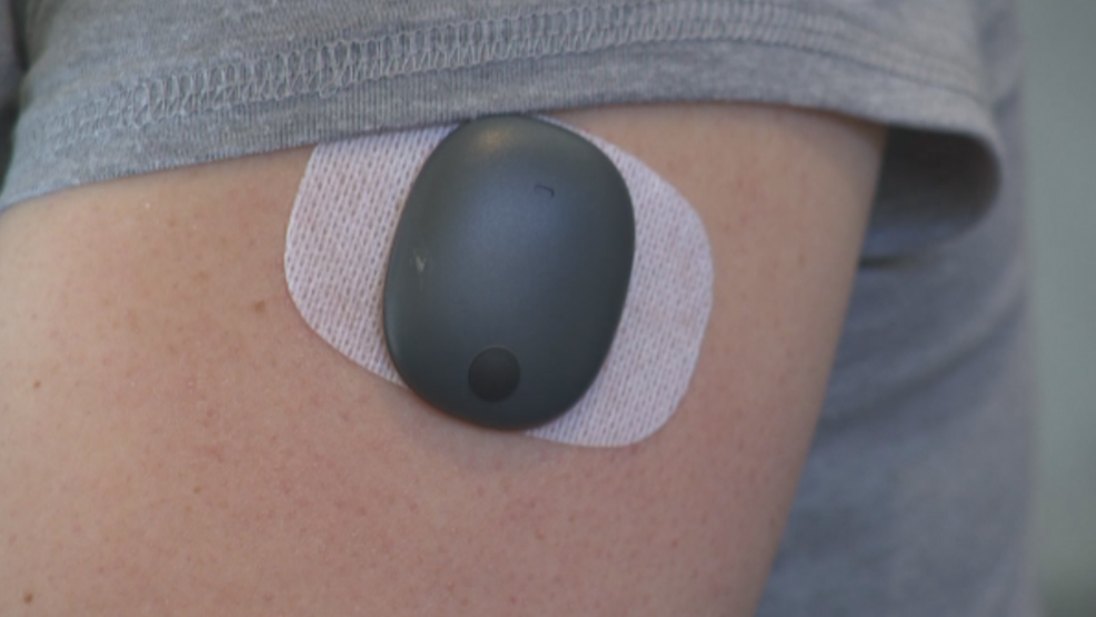 Maumelle woman among first Arkansans to get new glucose monitor implant