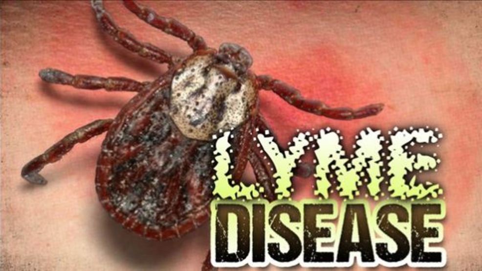 West Virginia reports increasing Lyme disease cases WCHS